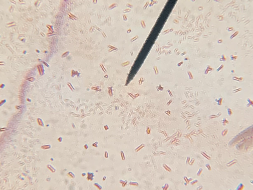 Gram Stained Bacteria